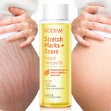 Anti-Stretch Marks & Scars Oil