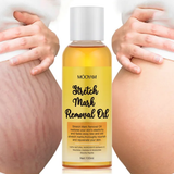 Stretch Mark Removal Oil